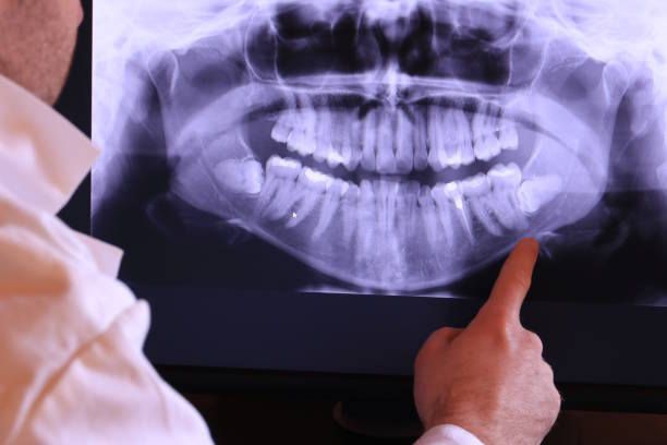 Best Emergency Treatment for Dental Infections or Abscesses in Cedar Hills, OR