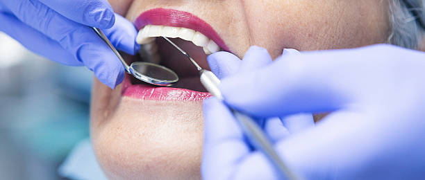Best Emergency Gum Treatment in Cedar Hills, OR
